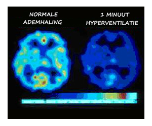 hersencellen hyperventilatie en normaal ademen